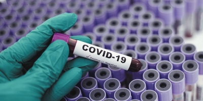 Πανεπιστήμιο Όρεγκον: «Σούπερ ανοσία» με εμβολιασμό και μόλυνση από covid -19, με οποιαδήποτε σειρά
