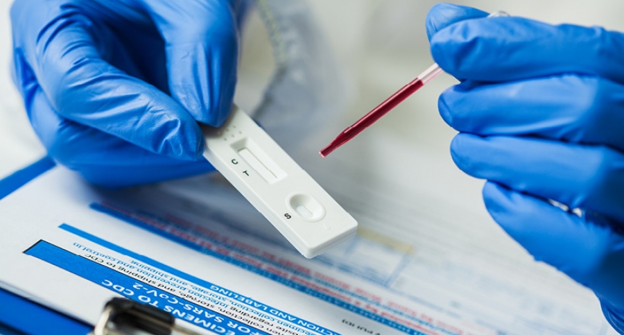 Κορωνοϊός: Ένα νέο τεστ αίματος αυτο-αντισωμάτων μπορεί να προβλέψει την πιθανότητα σοβαρής λοίμωξης