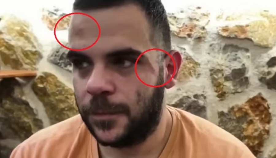 Επίθεση κατά του Youtuber Teosty στα Γιάννενα – Τράβηξε τα βλέμματα ενώ έκανε live