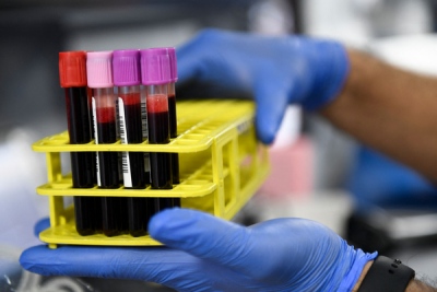 Προσοχή στους Ολλανδούς... όλοι έχουν χημικά στο αίμα τους