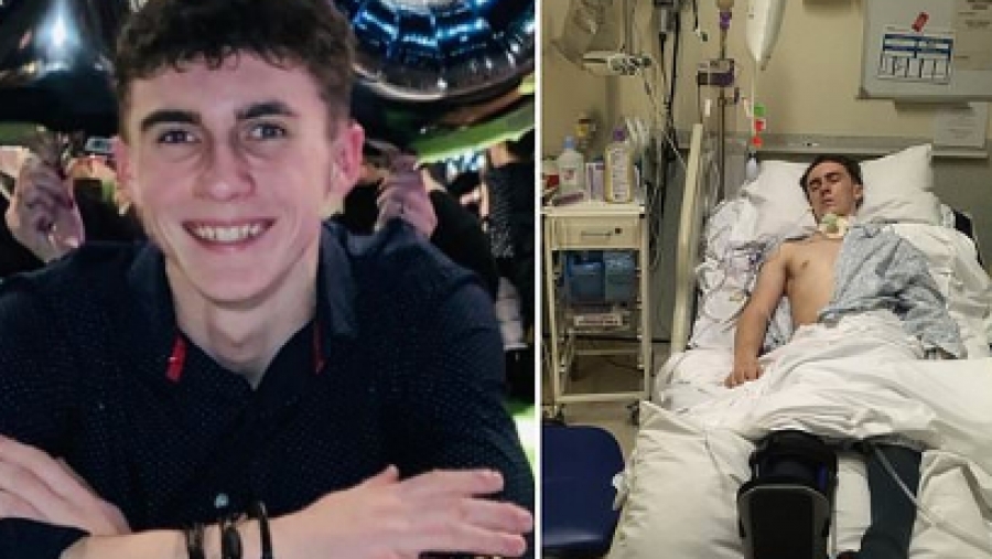 Έφηβος ήταν 1 χρόνο σε κώμα, μολύνθηκε 2 φορές από κορωνοϊό και «ξύπνησε» χωρίς να θυμάται την πανδημία