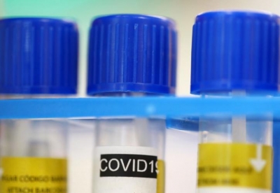 ΕΕ: Συμβόλαιο με την GSK για την προμήθεια 220.000 δόσεων πειραματικής θεραπείας κατά της Covid-19