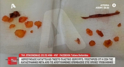 Ζητά 1 εκατ. ευρώ από πασίγνωστο πλαστικό των Αθηνών που της «εξαφάνισε» την μύτη στο χειρουργείο