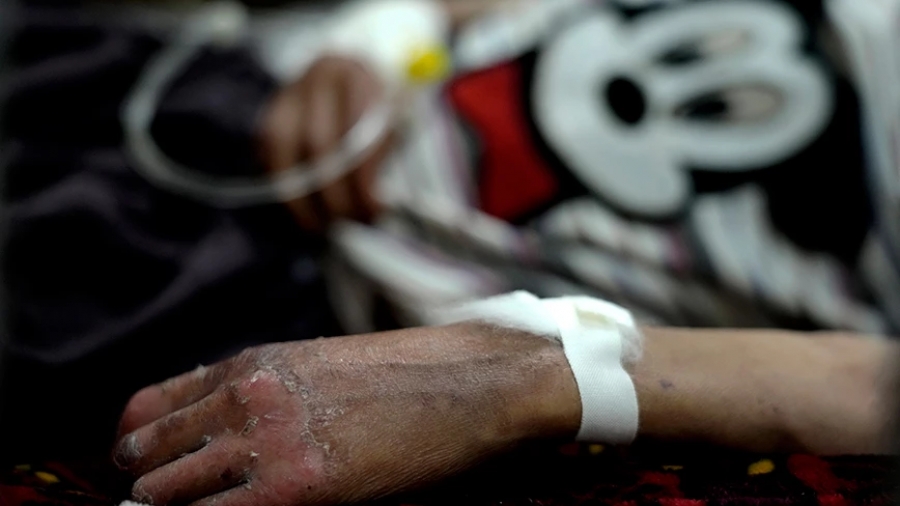 «Καμπανάκι» από τον ΟΗΕ: Οι μισές εγκαταστάσεις υγειονομικής φροντίδας στον κόσμο δεν έχουν ούτε νερό