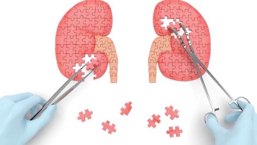 Χρόνια νεφρική νόσος - Μπορεί να προληφθεί;