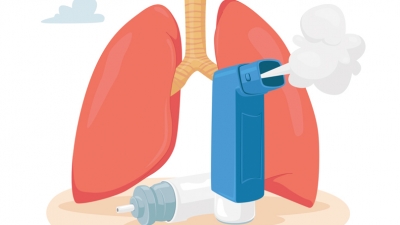 Βρογχικό άσθμα: Συμπτώματα, τύποι και θεραπεία