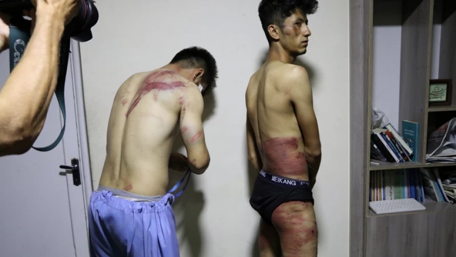 Αφγανιστάν: Ταλιμπάν βασάνισαν άγρια δύο δημοσιογράφους - Σκληρές εικόνες