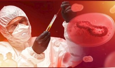 Ευλογιά των πιθήκων: 17 νέα κρούσματα μεταξύ ομοφυλόφιλων ανδρών στο Βέλγιο