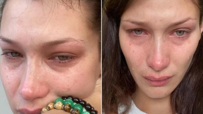 Η Bella Hadid δακρυσμένη για τα ψυχολογικά προβλήματα – «Κλαίω σχεδόν κάθε μέρα και νύχτα εδώ και χρόνια»
