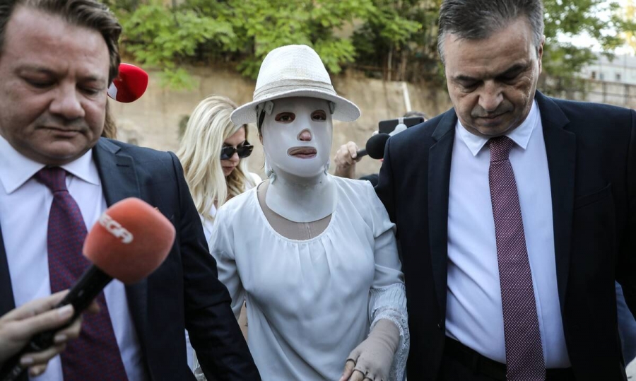 Δίκη για επίθεση με βιτριόλι: Καταθέτουν οι γιατροί - Σώθηκε από θαύμα η Ιωάννα