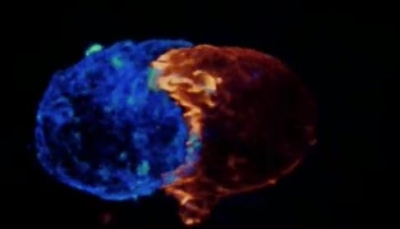 Συγκλονιστικό βίντεο: Ένα Τ- λεμφοκύτταρο σκοτώνει τον καρκίνο