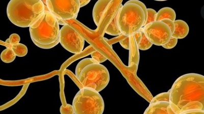 ΕΟΔΥ: Καμία ενεργή συρροή από Candida Auris αυτή τη στιγμή -  Δεν απειλεί άτομα εκτός νοσοκομείου και εκτός ΜΕΘ