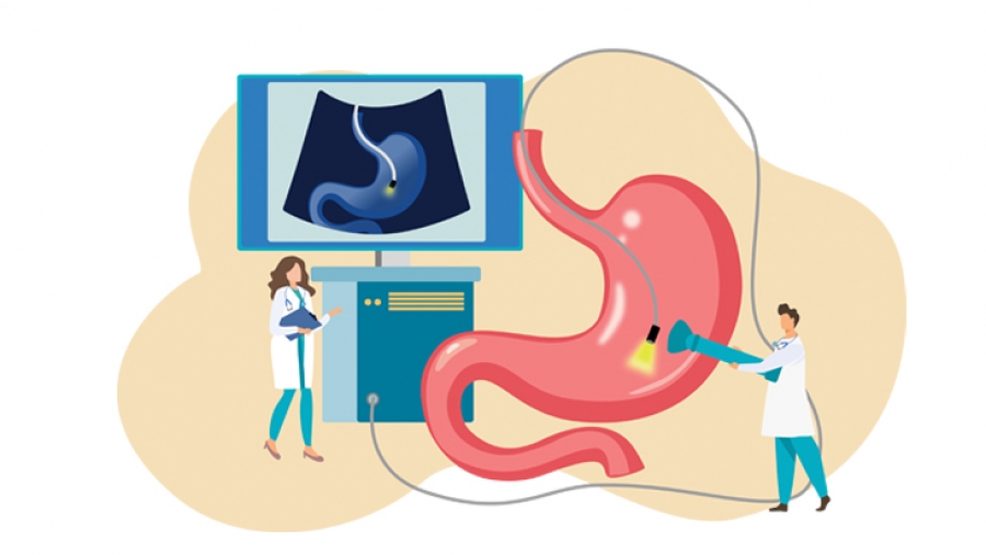 Οριστική λύση στην αχαλασία οισοφάγου και το εκκόλπωμα Zenker