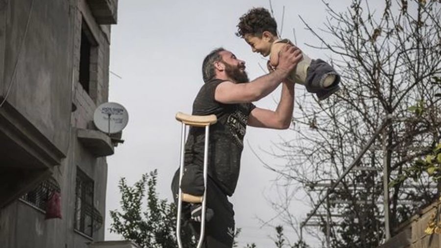 Η βραβευμένη φωτογραφία που συγκλονίζει: Ο ακρωτηριασμένος πατέρας και το παιδί χωρίς χέρια και πόδια