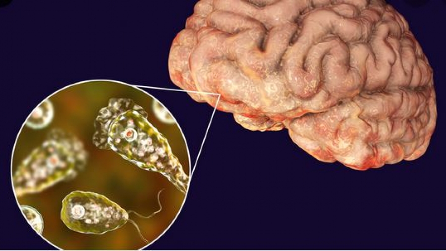 Ισραήλ - Υπουργείο Υγείας: Θάνατος 36χρονου χωρίς υποκείμενα νοσήματα από ναιγλερίαση – Από τι προκλήθηκε