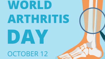 Μορφές αρθρίτιδας και σύγχρονες θεραπείες