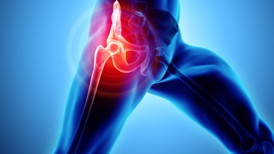 Αντιμετώπιση της οσφυοϊσχιαλγίας με laser