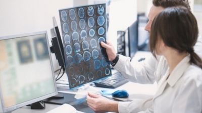 Αποκατάσταση μετά από αγγειακό εγκεφαλικό επεισόδιο (ΑΕΕ)