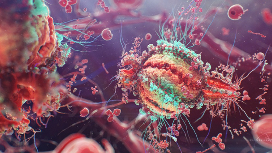 Και 2ος ασθενής με HIV (AIDS) θεραπεύτηκε - Ελπίδα με τη συμβολή Ελλήνων επιστημόνων