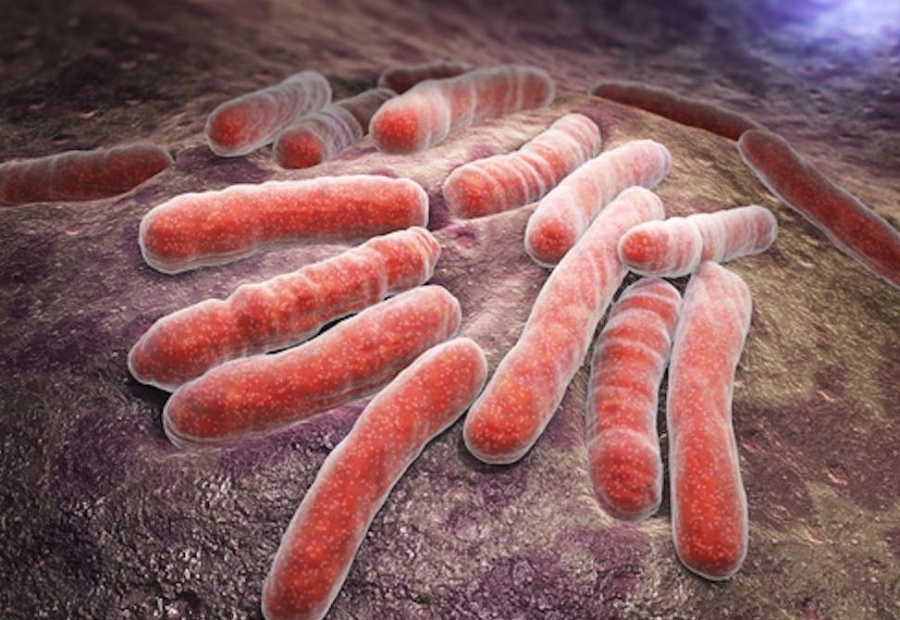 Πανικός σε ΗΠΑ με 10.350 κρούσματα φυματίωσης, επιστρέφει η θανάσιμη απειλή - Ψάχνουν τις εστίες έξαρσης