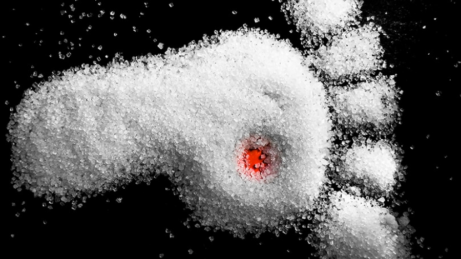 Διαβητικό Πόδι: Πρόληψη και θεραπεία