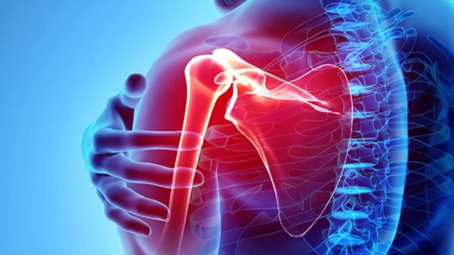 Ασβεστοποιός τενοντίτιδα - Αιτίες και διάγνωση