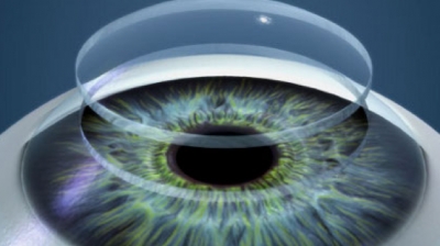 Οι 3D βιοεκτυπώσεις ανθρωπίνων ιστών και οργάνων