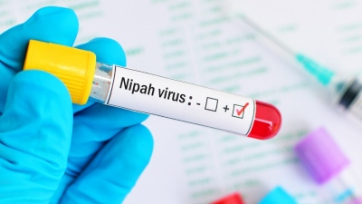 Συναγερμός στην Ινδία για τον θανατηφόρο ιό, Nipah - Κλείνουν σχολεία, τράπεζες και άλλα ιδρύματα