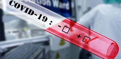 Βέλγιο: Δεκάδες νεαροί θετικοί στον κορωνοϊό μετά από ταξίδι στην Πορτογαλία