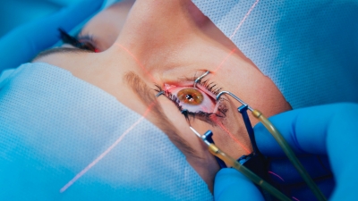 Καταρράκτης: Οι πιθανότητες να γίνει άνοια μια αναστρέψιμη απώλεια όρασης