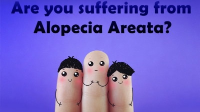 Γυροειδής αλωπεκία ή τριχοφάγος: Αίτια, συμπτώματα και αντιμετώπιση