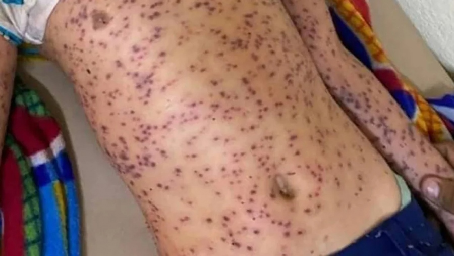 Εικόνες σοκ: Έξι νεκροί από τσιμπήματα μελισσών - δολοφόνων στη Νικαράγουα - Λεωφορείο έπεσε πάνω σε κυψέλες