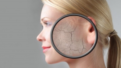 Ξηρό και αφυδατωμένο δέρμα