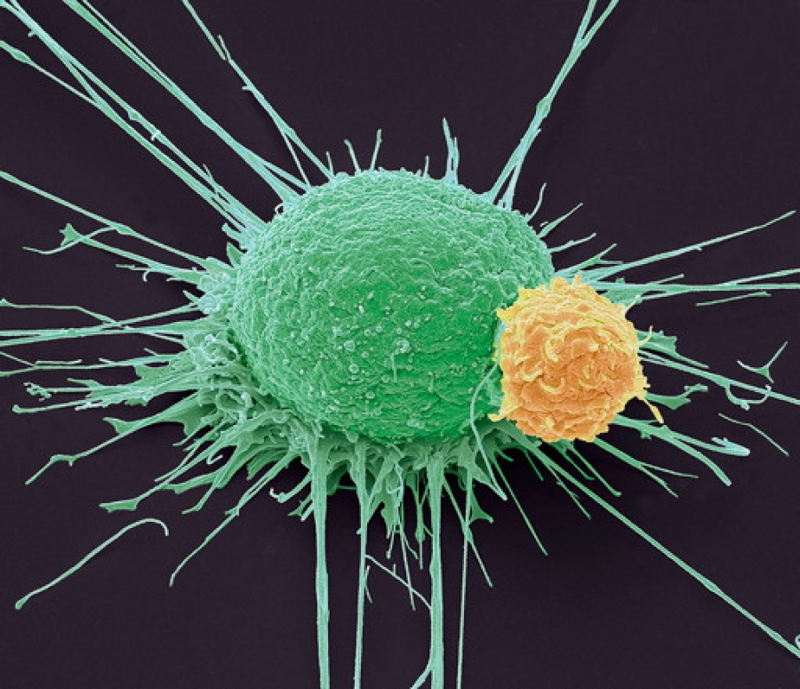Μελέτη - σοκ: Το «γενετικό χάος» οδηγεί σε ταχέως αναπτυσσόμενους καρκίνους - Πώς εκτοξεύθηκαν λόγω των εμβολίων mRNA