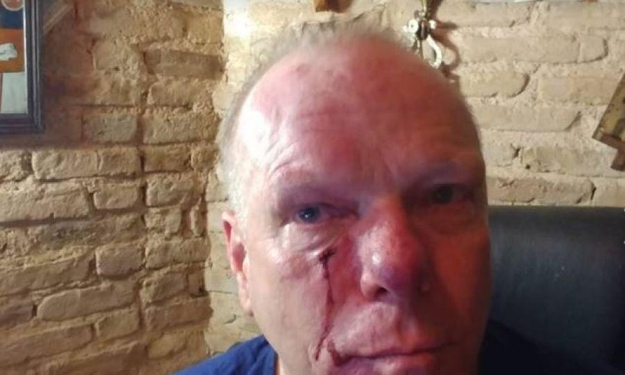 Καταδικάζει η Ένωση Ανταποκριτών Ξένου Τύπου την επίθεση στον φωτορεπόρτερ της Deutsche Welle