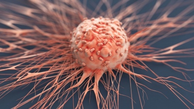 ΗΠΑ: Επαναστατική μέθοδος με «μοριακά κομπρεσέρ» κατέστρεψε το 99% των καρκινικών κυττάρων στο εργαστήριο