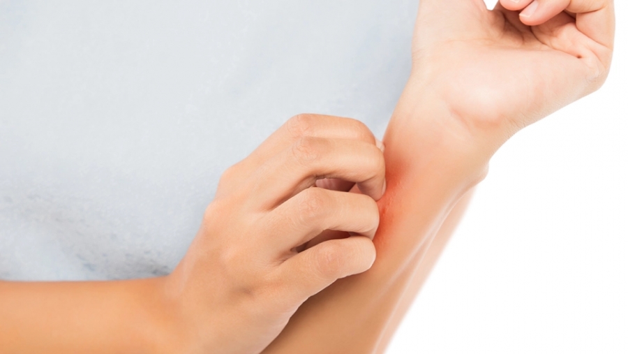 Κι όμως αυτό το δερματικό σύμπτωμα υποδηλώνει την ύπαρξη της μετάλλαξης Omicron - Τι να προσέξετε