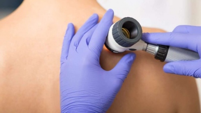 Η σημασία της τακτικής δερματολογικής εξέτασης