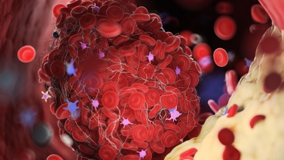 Διάγνωση των λιπιδίων που μπορεί να σώσει τη ζωή μας