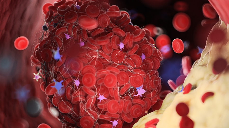 Διάγνωση των λιπιδίων που μπορεί να σώσει τη ζωή μας