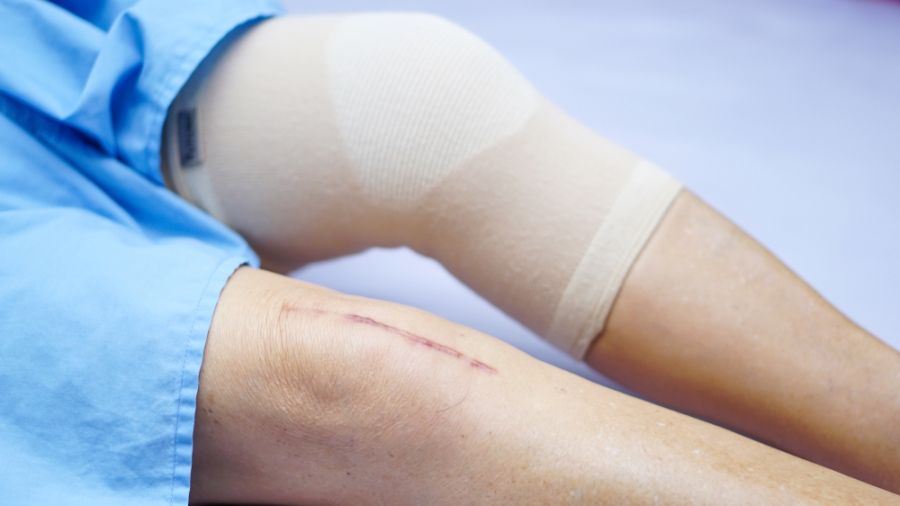 Αρθροπλαστική: Nεότερα δεδομένα και οφέλη για τον ασθενή