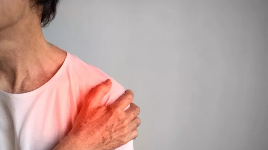 Η ασβεστοποιός τενοντίτιδα ώμου μέσα 5 ερωταπαντήσεις