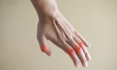 Σύγχρονες μέθοδοι για την αντιμετώπιση της αρθρίτιδας