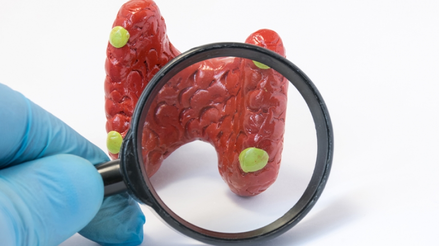 Παθήσεις των παραθυρεοειδών αδένων και χειρουργική αντιμετώπιση