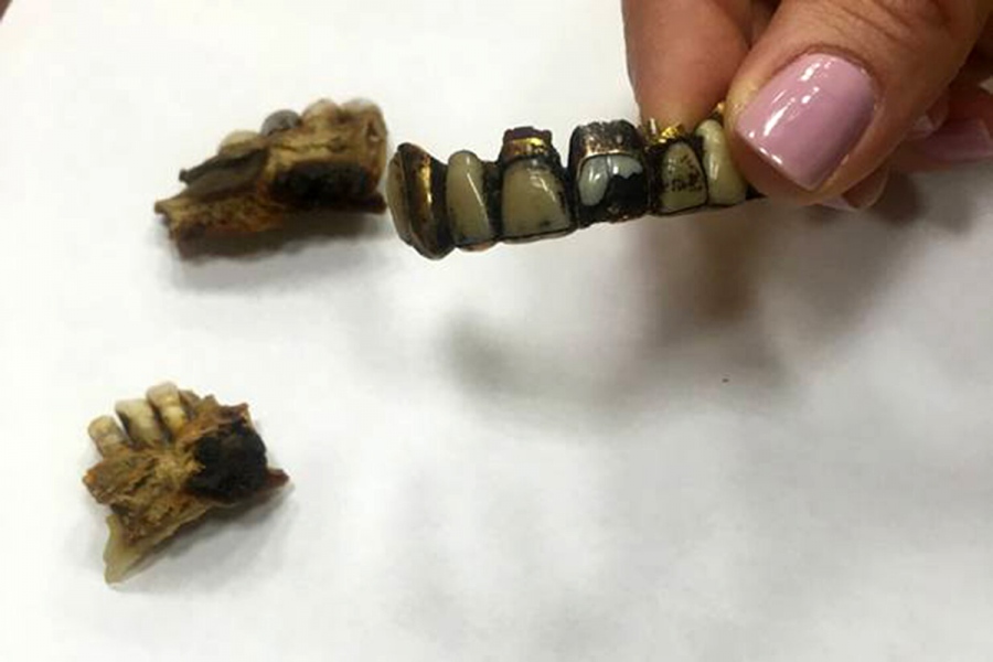 Δημοσιεύτηκε: Αυτό είναι το σαγόνι του Χίτλερ - Πού φυλάσσεται - Τελικά αυτοκτόνησε;