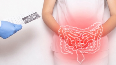 Ασθενείς με ιδιοπαθείς φλεγμονώδεις νόσους του εντέρου στην εποχή της πανδημίας