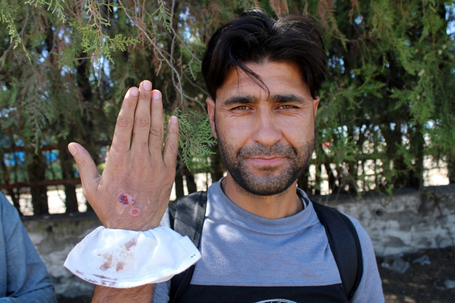 Προπαγάνδα με φανταστικές ιστορίες – Υeni Safak: Οι έλληνες βασανίζουν μετανάστες