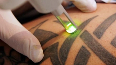 Η ΕΕ απαγορεύει τα χρωματιστά τατουάζ από τις 4 Ιανουαρίου - Τι φοβήθηκαν οι ειδικοί