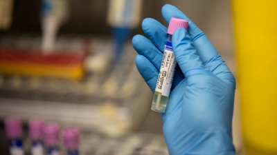 Παγκόσμιος Οργανισμός Υγείας: Αύξηση των θανάτων από ευλογιά των πιθήκων στην Ευρώπη