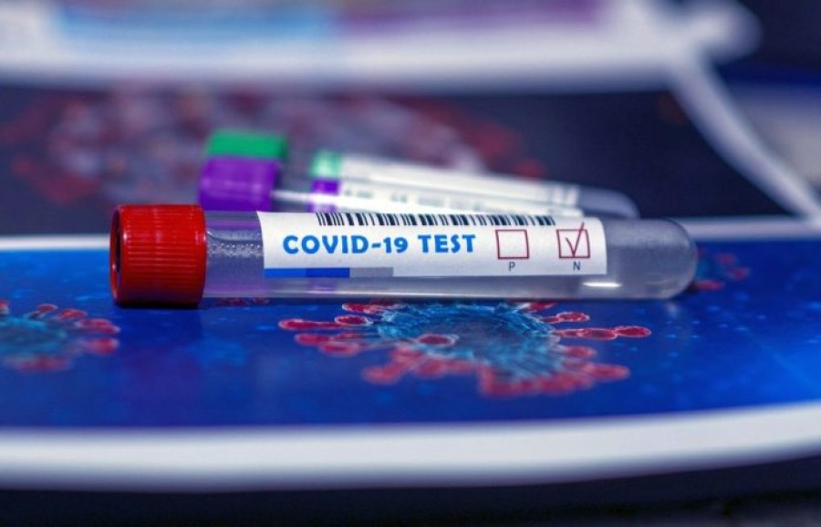 Αυτά είναι τα κριτήρια της IATA για τα τεστ Covid-19 στα αεροπορικά ταξίδια